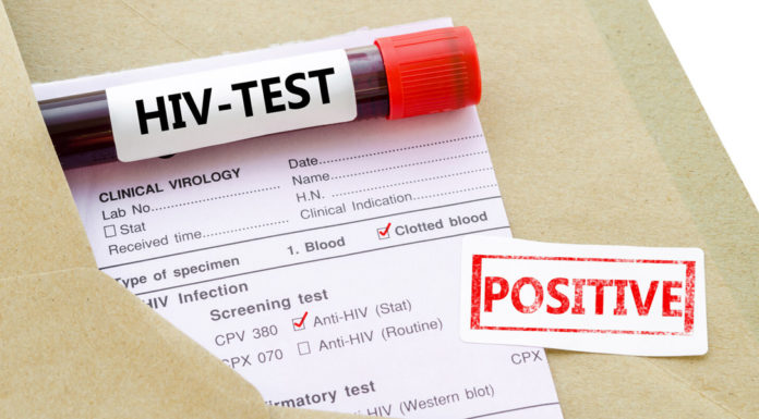 An Overview of the Different Type of HIV Tests Available