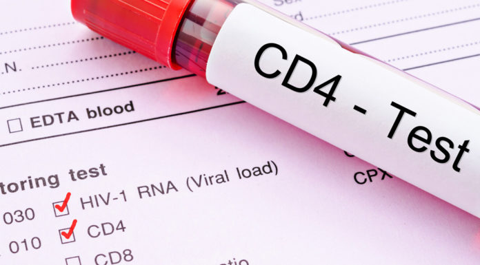 HIV by the Numbers: An Introduction to CD4 Count and Viral Load