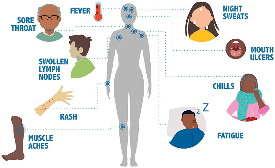 A graphic demonstrating HIV symptoms / CDC